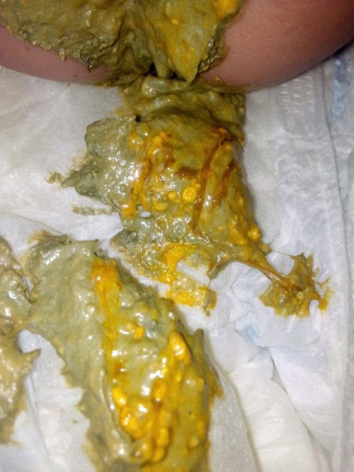 Lumot and peanut butter color ng poops ni baby normal lang ba?