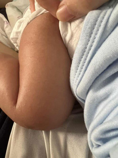 ลูก เเม่ๆท่านไหนเป็นเเบบนี้บ้างคะ🥺