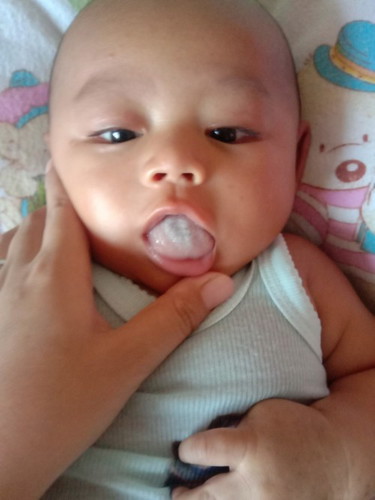 Lidah bayi