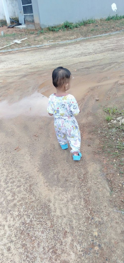 Hasil Mantoux positif