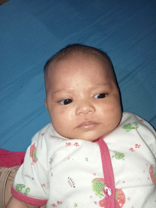 Gatal² merah² di muka