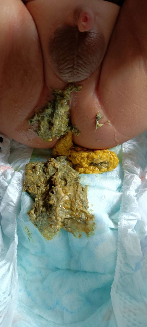 Normal ba ang green poop?