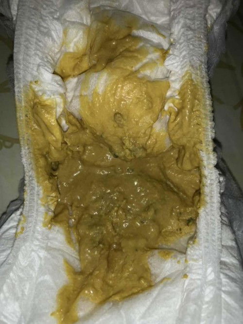 เปลี่ยนนมให้น้องท้องเสียหรือป่าว