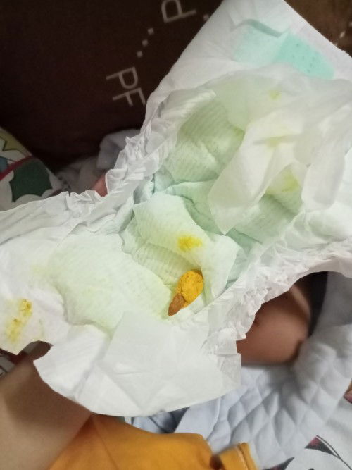 ลูกถ่ายแบบนี้ปกติมั่ยค่ะ