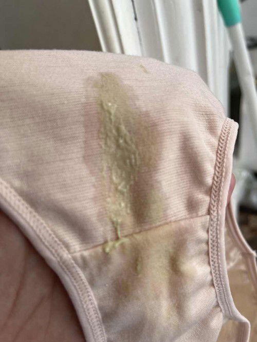 Keputihan dari awal hamil