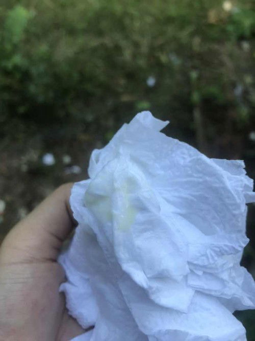 ตกขาวแบบนี้อันตรานไหมคะ