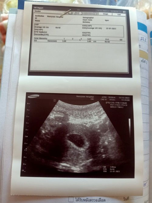 สวัสดีคะ แม่ๆ เราท้องลูกที่3 อีก2คนเป็นผู้ชาย ท้องนี้แม่สิวเต็มหน้าเลยคะ 10สัปดาห์