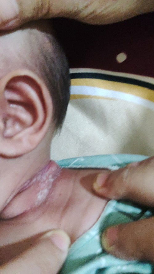 Sharing tentang sufor Dan obat ruam kulit