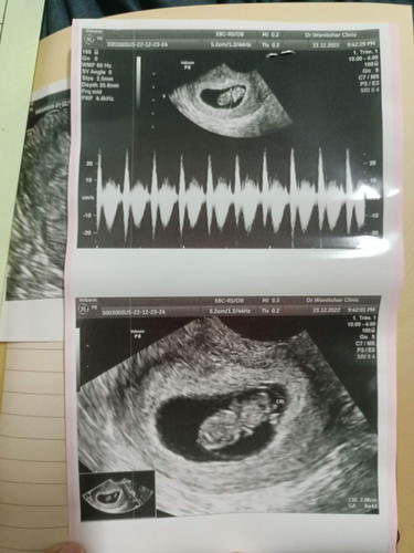8week2day