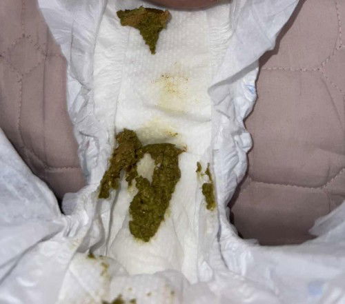 Najis baby newborn 1 bulan