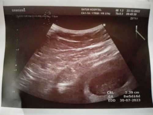 ช่วยดูเพศให้หน่อยจ้า