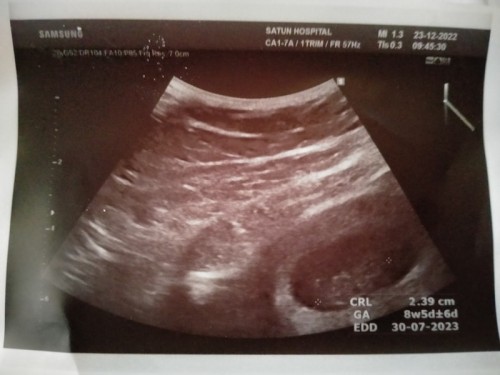 ช่วยดูเพศให้หน่อยจ้า