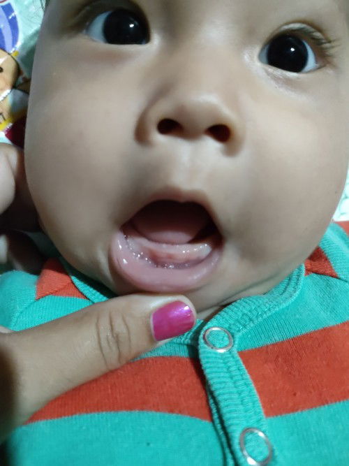 Bayi mau tumbuh gigi