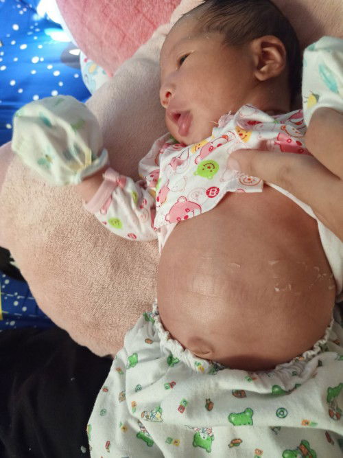 ท้องลูกเป็นแบบนี้ตลอดเลย
พึ่งสังเกตดูตอนน้องได้5วัน ตอนนี้น้องได้10วัน ท้องยังเป็นแบบนี้เหมือนเดิม