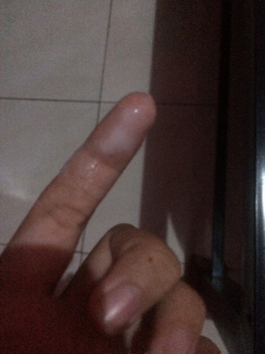 Mau nanya ini keputihan atau apa yaa