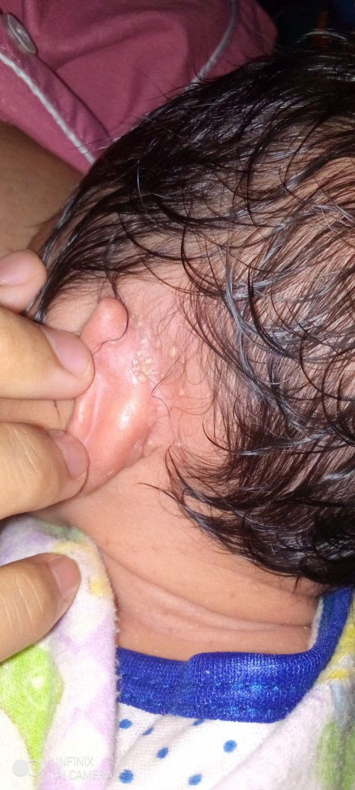 Ini cacar atau bukan ya Bun..?