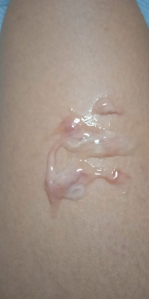 ใช่มูกเลือดมั้ยค่ะ