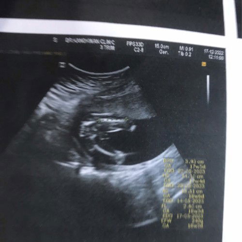 สอบถามแม่ๆค่ะ