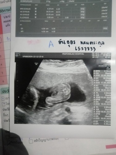 มีลูกแฝดควรดูแลยังไงบ้างค่ะ