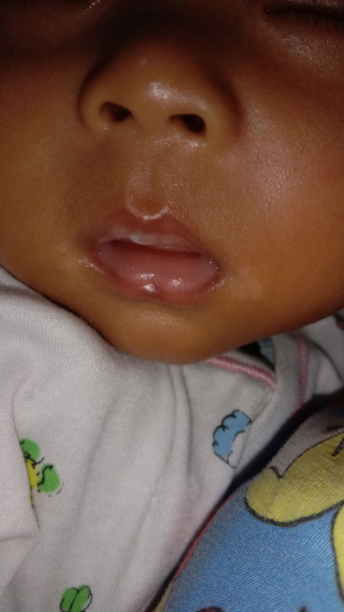 Putih dipinggir bbir