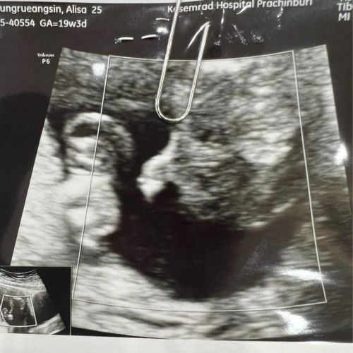 ทีมพฤษภาคม 66