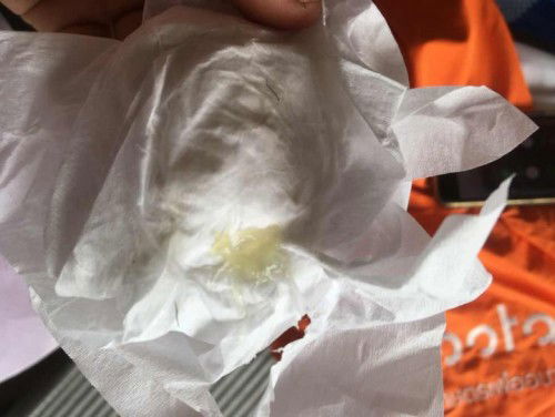 สอบถามแม่ๆหน่อยค่ะตอนนี้37+3วีคw แล้วค่ะอันนี้มูกใสใช่ไหมคะเราต้องไปโรงบาลไหมค่ะ