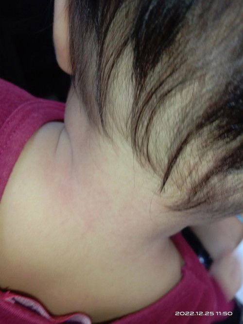 Bayi 6bln Bru baik demam