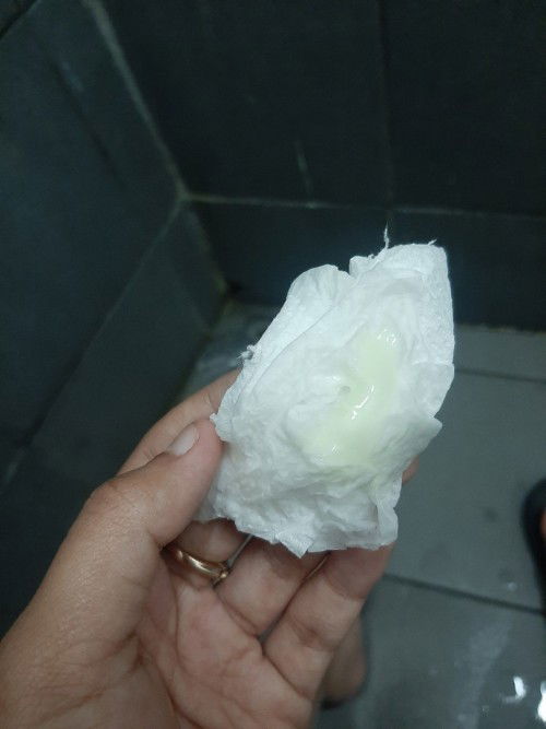 Apakah keputihan seperti ini aman ya bun? Kehamilan 8w.. bantu sharing ya bun 🙏
