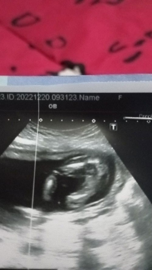 อยากทราบเพศ