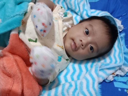ลูกน้อยหายใจครืดคราดผิดปกติมั้ยค่ะไม่มีไข้