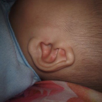 Daun telinga terlipat