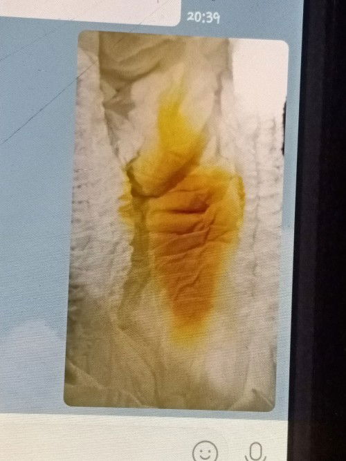 สอบถามค่ะแม่ๆบ้านนี้ลูก3เดือน25วันลูกถ่ายเป็นน้ำสองครั้งแล้วแต่ไม่งอแงค่ะ เป็นอาการผิดปกติไมค่ะ