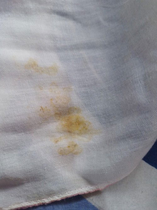 Pusar bayi keluar cairan