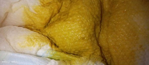 Nagtatae na 8 months