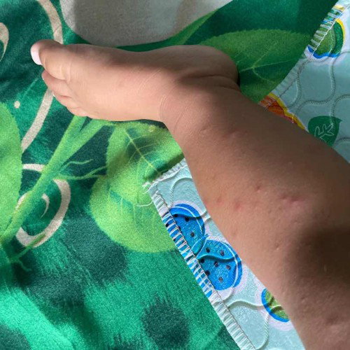 kaki bayi usia 8 bulan