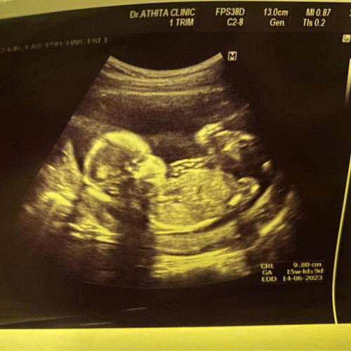 อยากรู้จังผญ.หรือผช.กันน้าาา
แม่ๆรู้เพศลูกตอนกี่วีคกันบ้างคะ
แบ่งปันรูปเจ้าตัวเล็กกันหน่อยค่าา