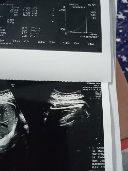 สอบถามเพศลูก