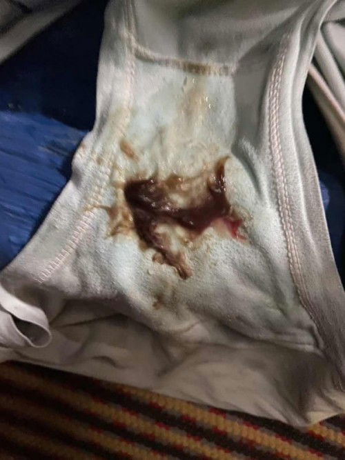 Bun apakah ini tanda persalinan