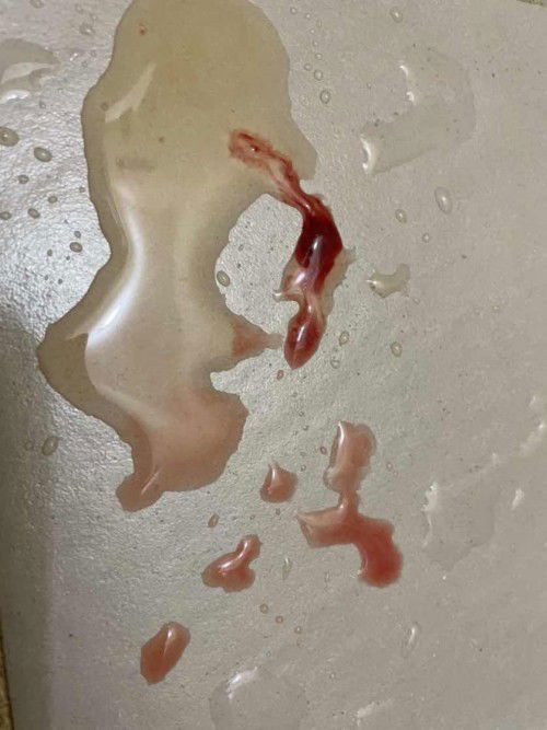 Lendir bercampur darah