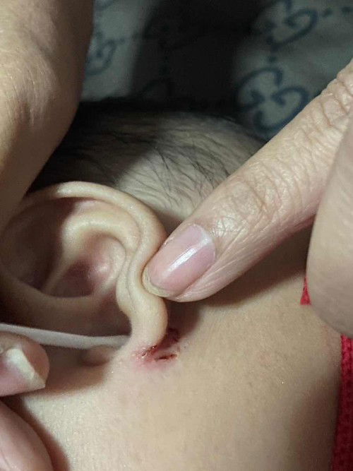 หูลูกเป็นแผล รบกวนช่วยแนะนำวิธีรักษาหน่อยค่ะ