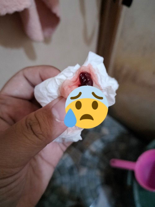 Waktu tespek garis 2 tp 1 masih samar, dan hari ini malah keluar begini. Ada yg tau ga bun?