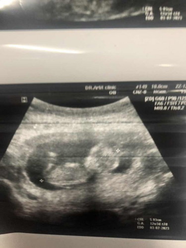 เเม่ๆช่วยดูเพศช่วยหน่อยค้า