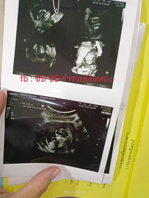 แม่ๆทราบเพศลูกกันหรือยังคะ