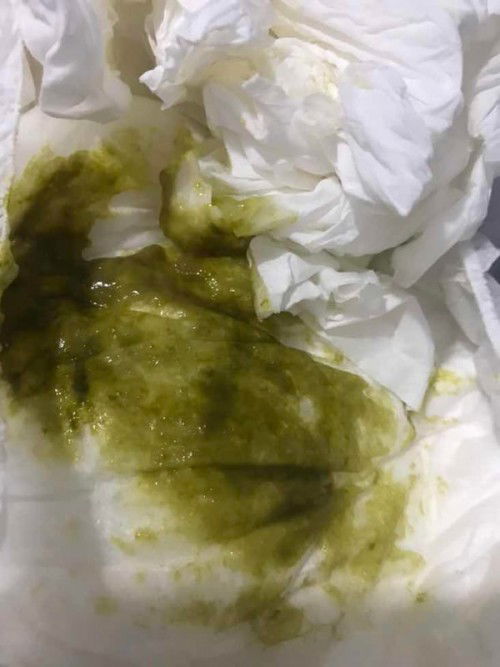 Fases seperti ini apakah aman ya mom??