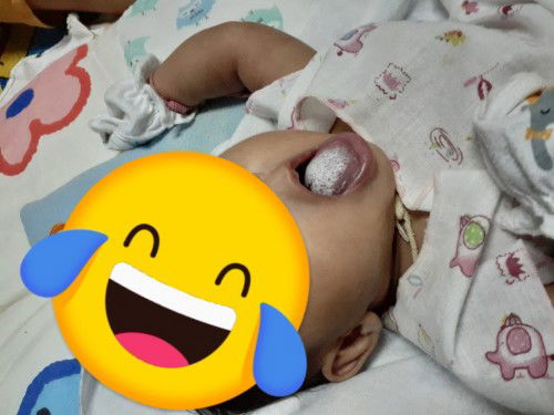 น้องกินนมผงลิ้นหนามากใช้อะไรเช็ดดี