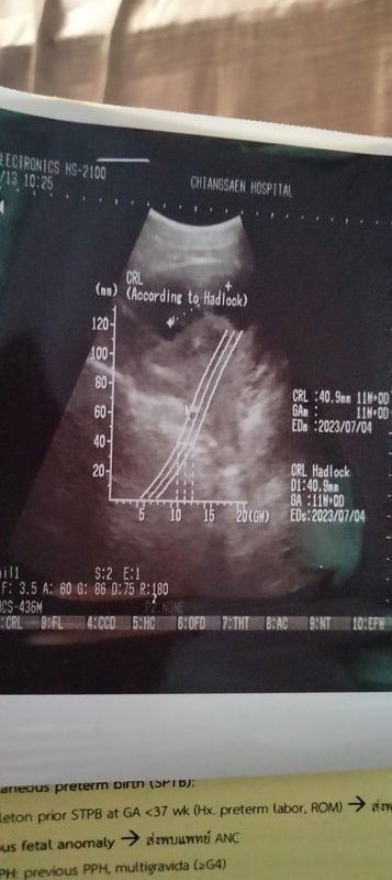 แม่ๆท่านไหนพอดูออกบ้างค่ะน้องอยู่ตรงไหนท้องแรกค่ะมองไม่ออก