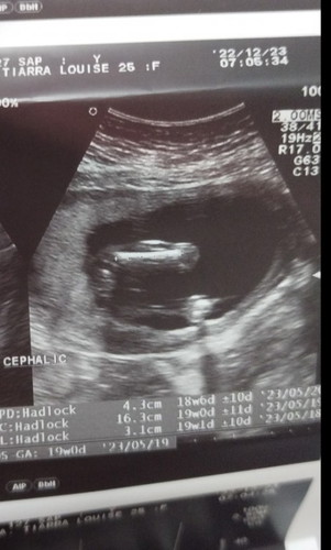 Ano po kaya ang gender ? Ayaw pang sabihin ng ob.babalik ulit ako after 2 months😅