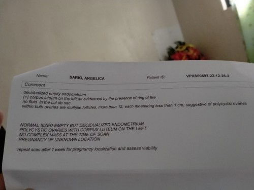 buntis ba o hindi? o ectopic?