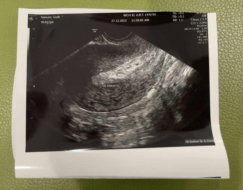 Masih berpantang keguguran