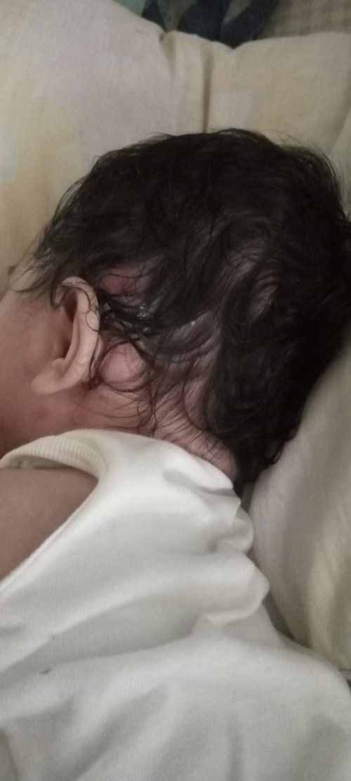 Anu gamot s butlig n my nana,naging pigsa n sa ulo dumadami po at malalaki.. pa help nman po